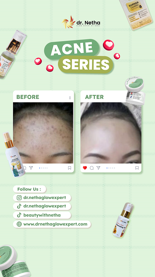 Foto Testimoni dr. Netha Glow Expert 6